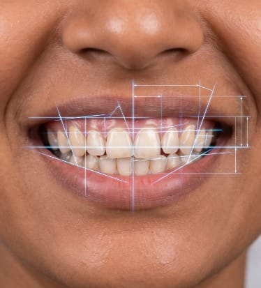 Before: Digital Smile Design
