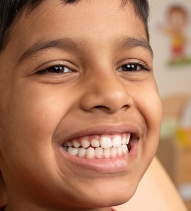 After: Pediatric dentistry